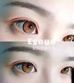 美瞳
