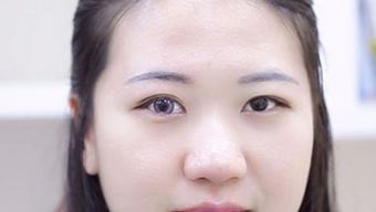 美瞳护理 使用方法