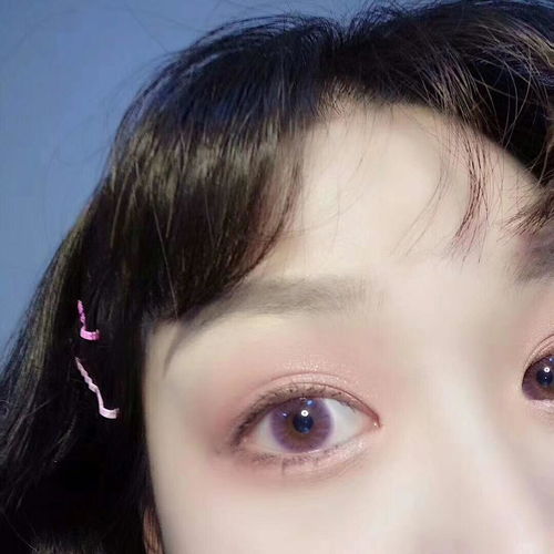 美瞳小知识